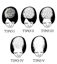 World Hair Research Hair Scales Charts